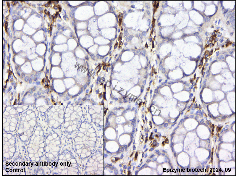 Anti-SIRT2 Rabbit mAb [68A65P55]