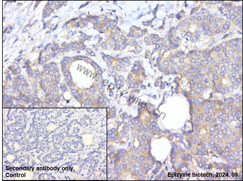 Anti-SIRT2 Rabbit mAb [68A65P55]