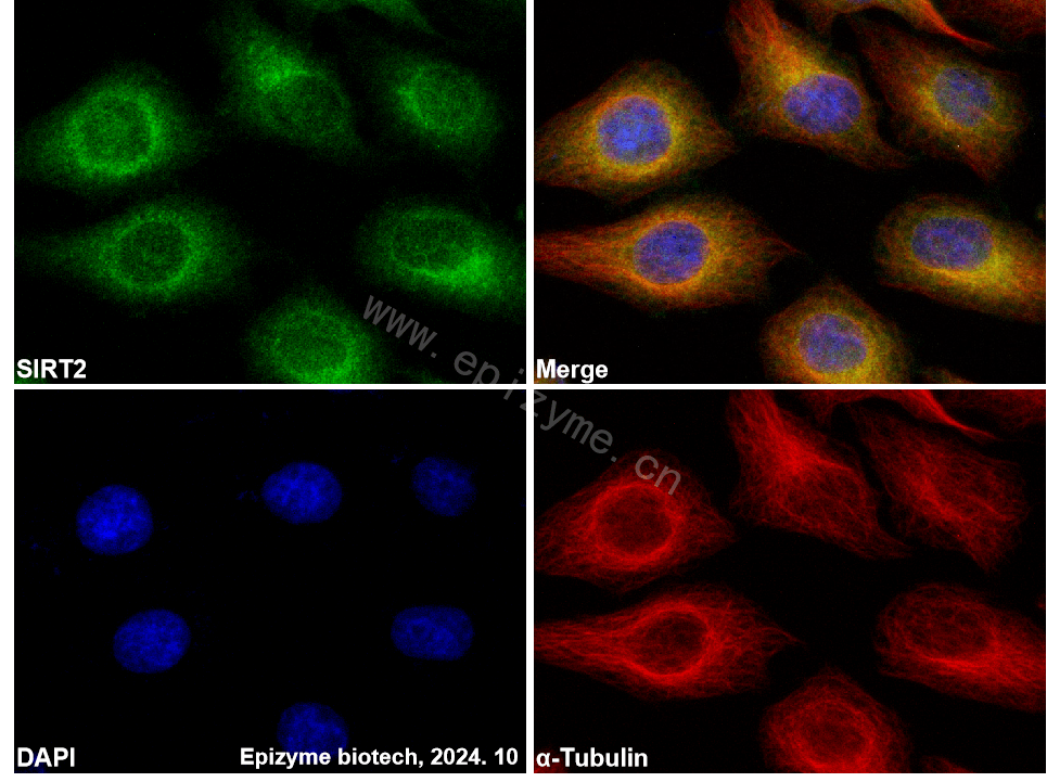 Anti-SIRT2 Rabbit mAb [68A65P55]