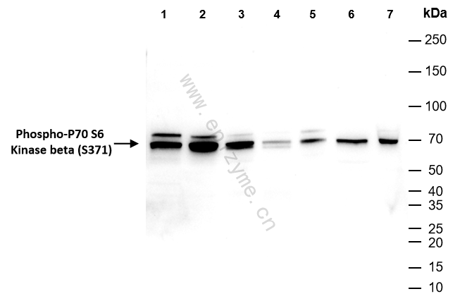 Anti-Phospho-p70 S6 kinase beta 2 (Ser370) Rabbit mAb [79E69C08]