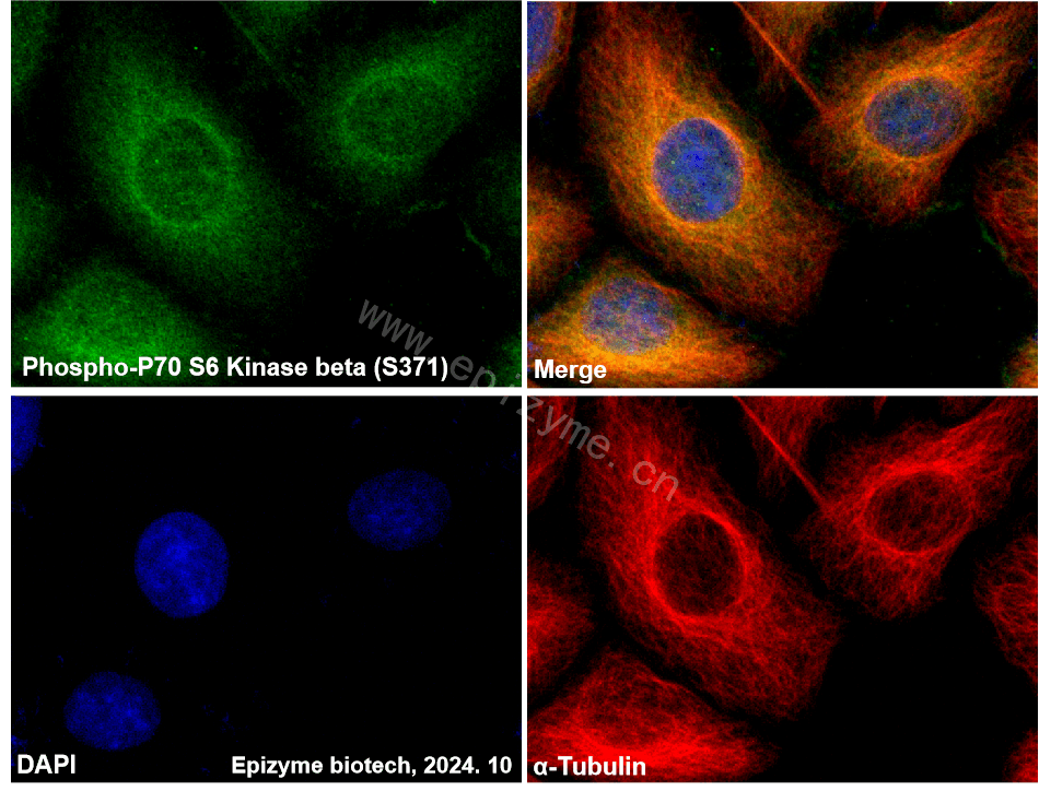 Anti-Phospho-p70 S6 kinase beta 2 (Ser370) Rabbit mAb [79E69C08]