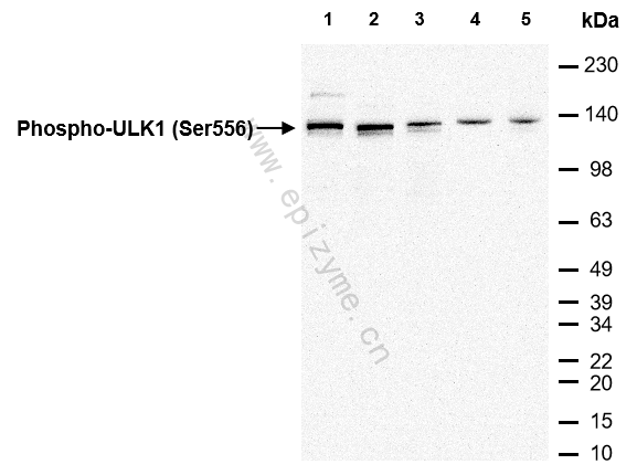 Anti-Phospho-ULK1 (Ser556) Rabbit mAb [31H54T17]