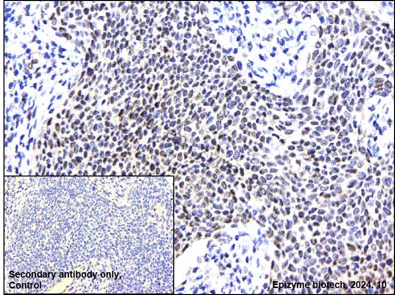 Anti-Phospho-ULK1 (Ser556) Rabbit mAb [31H54T17]