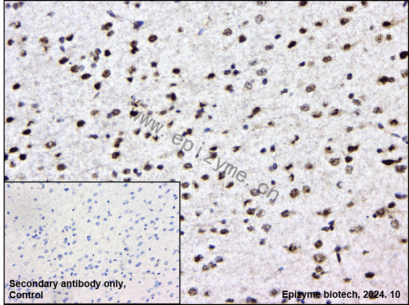 Anti-Phospho-ULK1 (Ser556) Rabbit mAb [31H54T17]