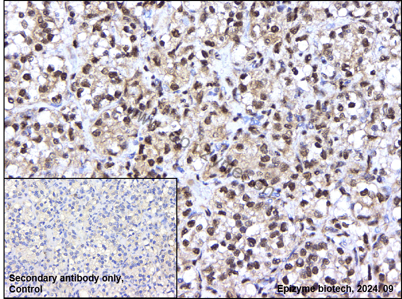 Anti-Phospho-ULK1 (Ser556) Rabbit mAb [31H54T17]