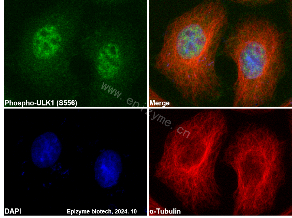 Anti-Phospho-ULK1 (Ser556) Rabbit mAb [31H54T17]