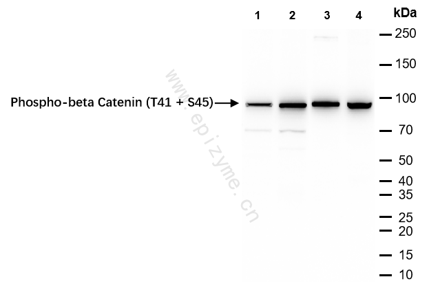 Anti-Phospho-beta Catenin (Thr41/Ser45) Rabbit mAb [55T66J80]