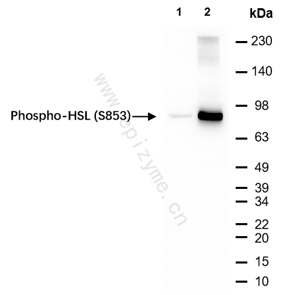 Anti-Phospho-HSL (Ser853) Rabbit mAb [73O79J75]