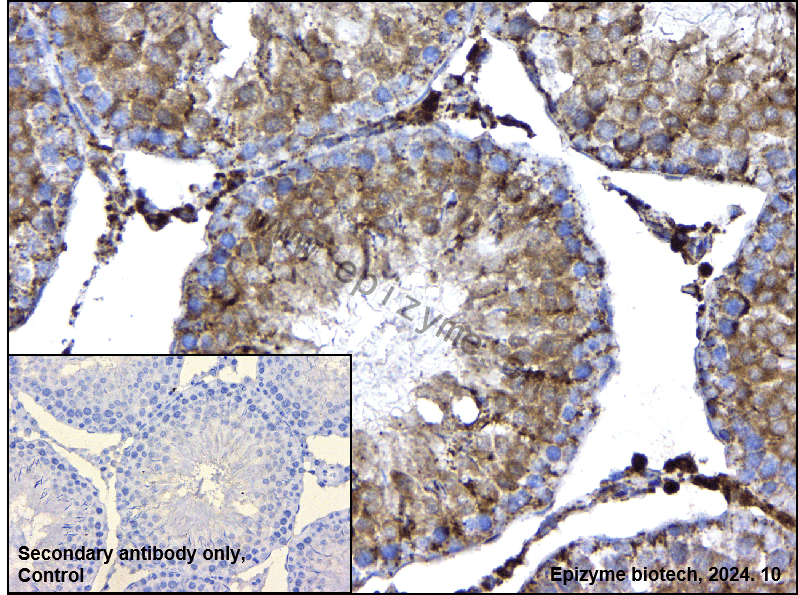 Anti-Phospho-HSL (Ser853) Rabbit mAb [73O79J75]