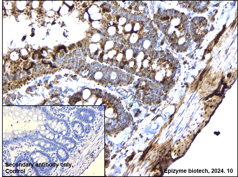 Anti-Phospho-HSL (Ser853) Rabbit mAb [73O79J75]