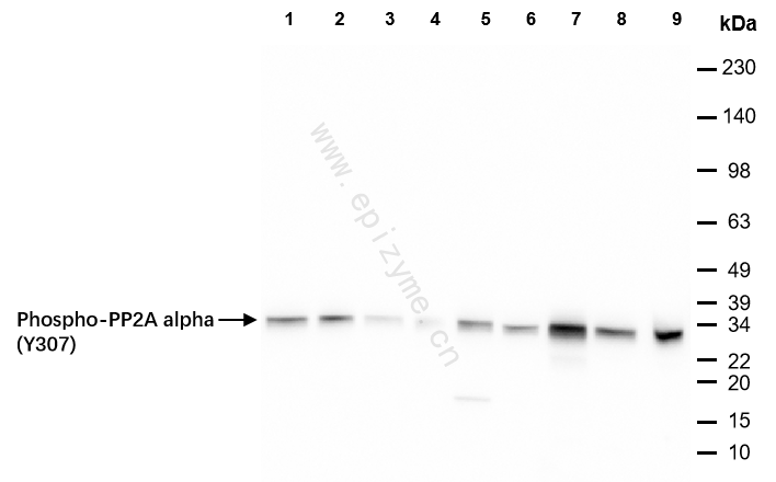 Anti-Phospho-PP2A alpha (Tyr307) Rabbit mAb [57M05O52]