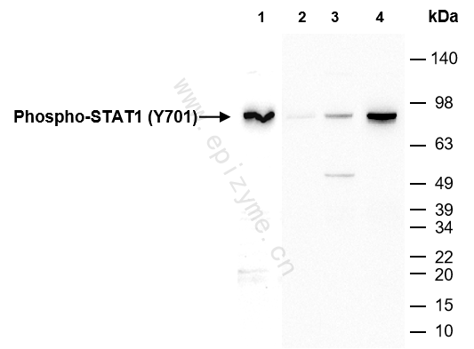 Anti-Phospho-STAT1 (Tyr701) Rabbit mAb [62J91S75]