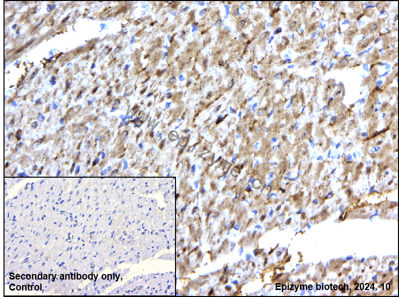 Anti-TC10 Rabbit mAb [57P53A87]