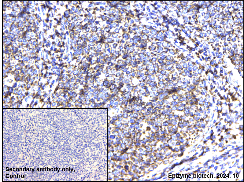Anti-TC10 Rabbit mAb [57P53A87]