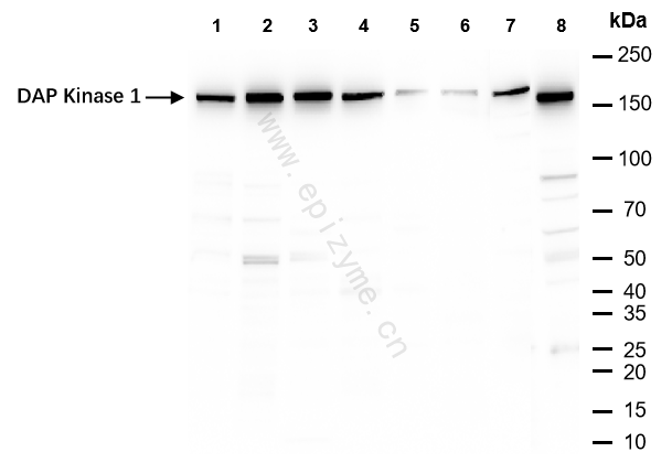 Anti-DAP Kinase 1 Rabbit mAb [19G20A34]