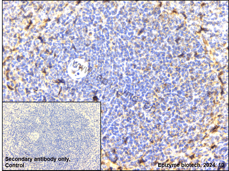 Anti-DAP Kinase 1 Rabbit mAb [19G20A34]