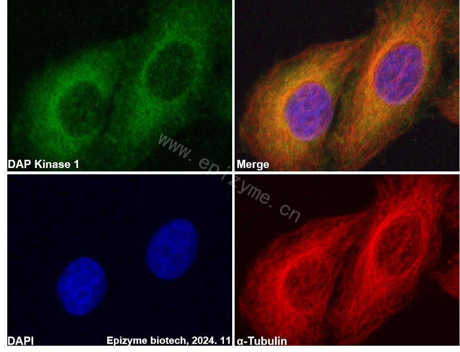 Anti-DAP Kinase 1 Rabbit mAb [19G20A34]