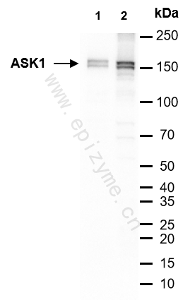 Anti-ASK1 Rabbit mAb [25G74I07]