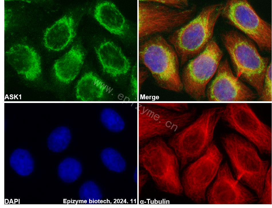 Anti-ASK1 Rabbit mAb [25G74I07]