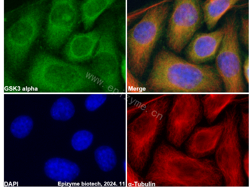 Anti-GSK3 alpha Rabbit mAb [63I72N28]