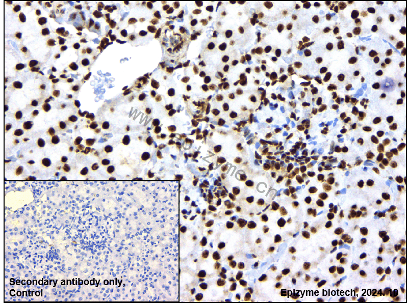 Anti-HMGB1 Rabbit mAb [20M98D47]