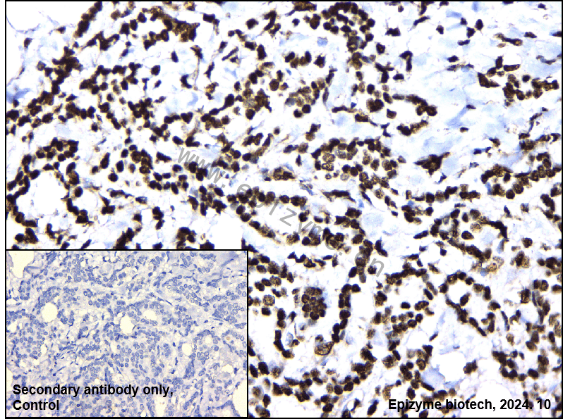 Anti-HMGB1 Rabbit mAb [20M98D47]