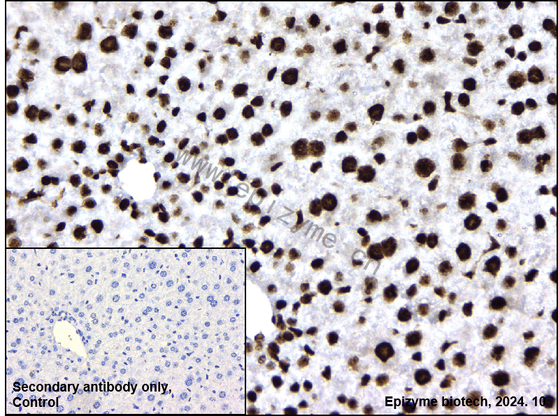 Anti-HMGB1 Rabbit mAb [20M98D47]
