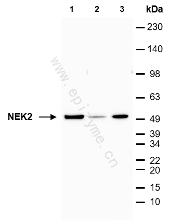 Anti-NEK2 Rabbit mAb [90I84G70]