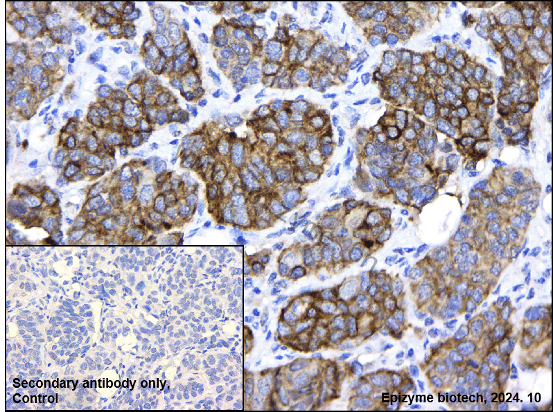 Anti-NEK2 Rabbit mAb [90I84G70]