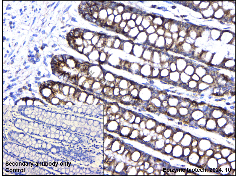 Anti-NEK2 Rabbit mAb [90I84G70]