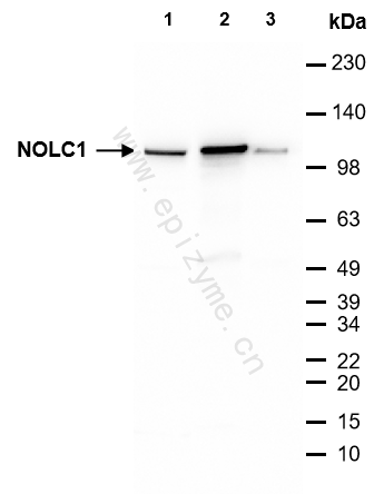 Anti-NOLC1 Rabbit mAb [21M67M04]