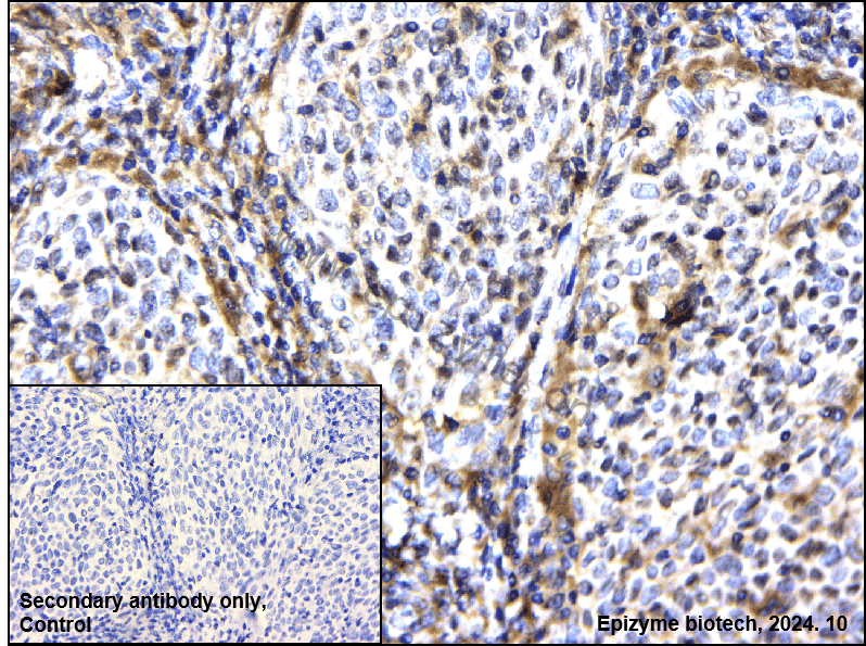 Anti-NOLC1 Rabbit mAb [21M67M04]