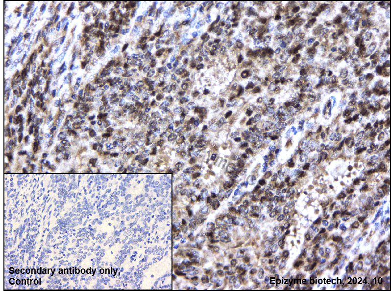 Anti-NOLC1 Rabbit mAb [21M67M04]