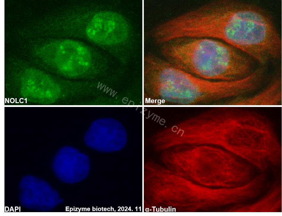 Anti-NOLC1 Rabbit mAb [21M67M04]