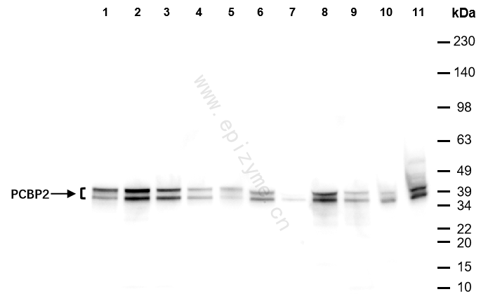 Anti-PCBP2 Rabbit mAb [91F71C66]