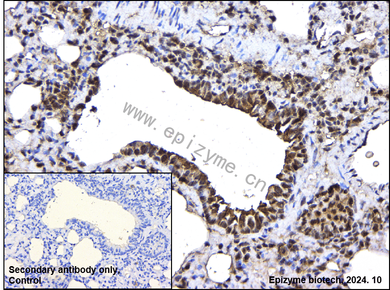 Anti-PCBP2 Rabbit mAb [91F71C66]