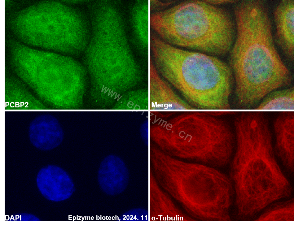 Anti-PCBP2 Rabbit mAb [91F71C66]