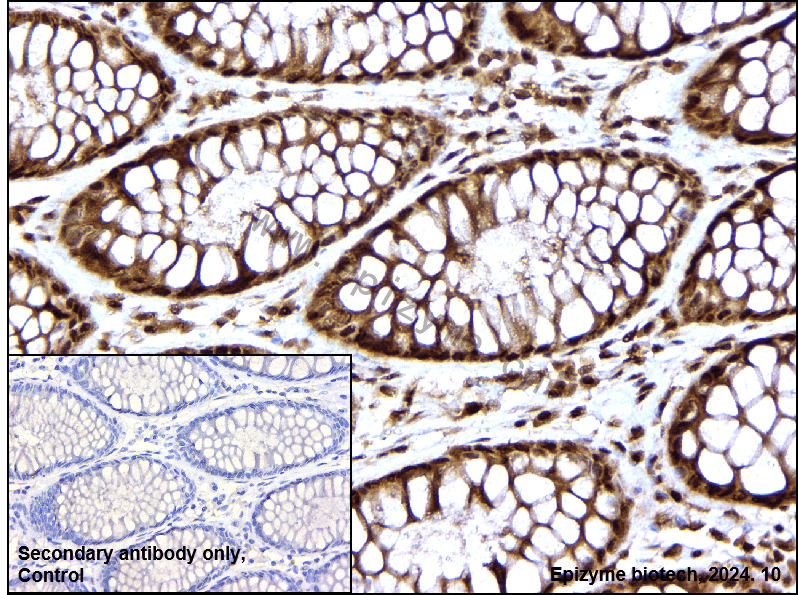 Anti-ROC1 Rabbit mAb [70D87E99]