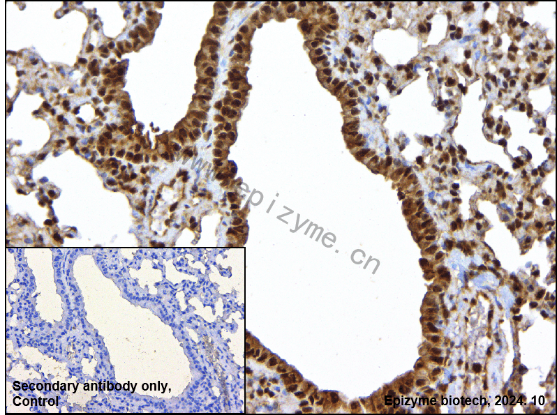 Anti-ROC1 Rabbit mAb [70D87E99]
