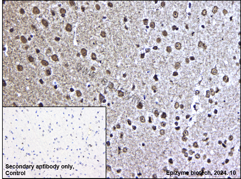 Anti-SAM68 Rabbit mAb [93J28R39]
