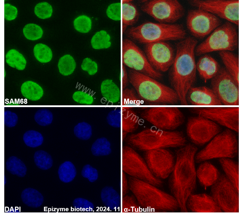 Anti-SAM68 Rabbit mAb [93J28R39]