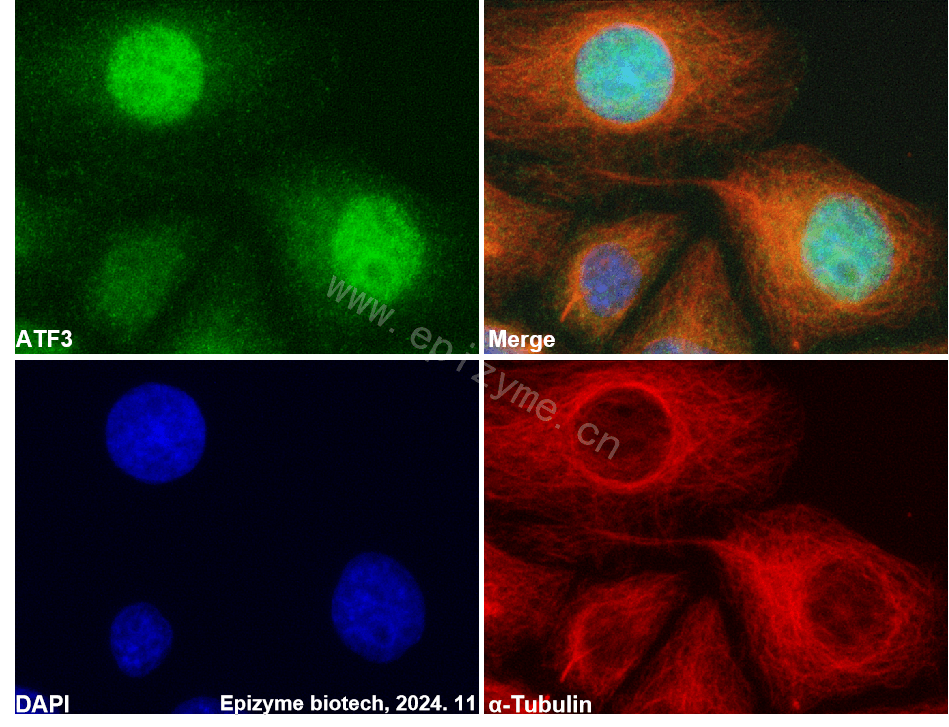 Anti-ATF3 Rabbit mAb [23Q72M20]