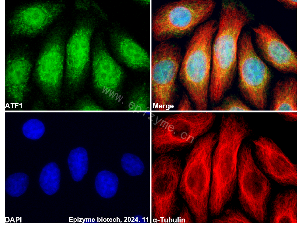 Anti-ATF1 Rabbit mAb [91D78Q99]
