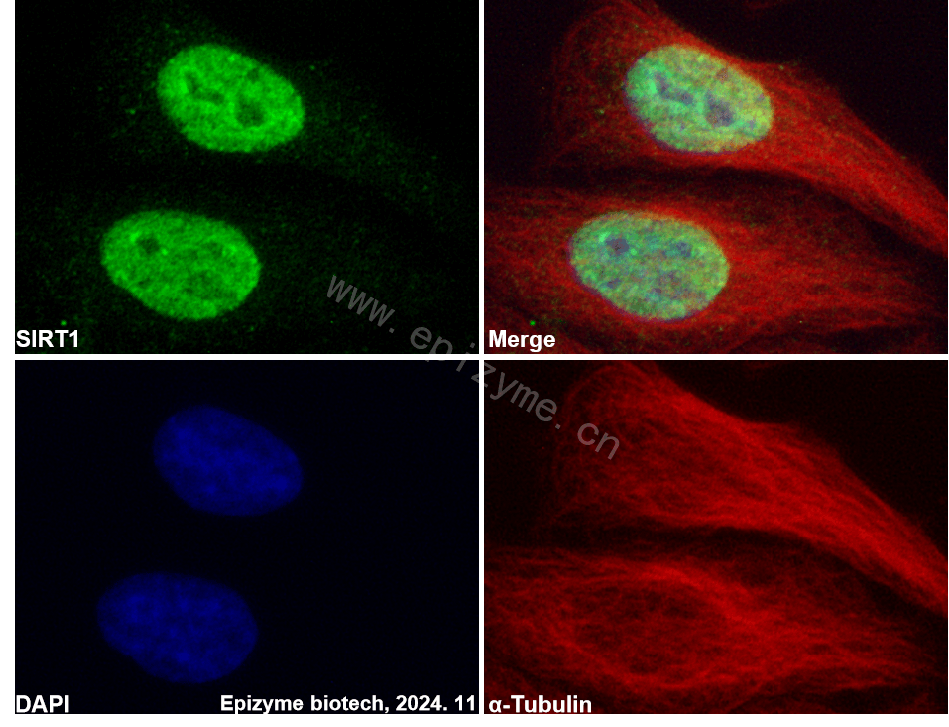Anti-SIRT1 Rabbit mAb [32R67H94]