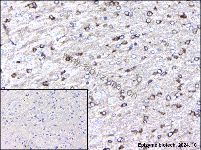 Anti-Phospho-PAK1/2/3 (Ser144+Ser141+Ser139) Rabbit mAb [51K37R33]