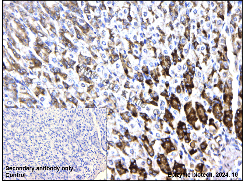 Anti-Phospho-PAK1/2/3 (Ser144+Ser141+Ser139) Rabbit mAb [51K37R33]