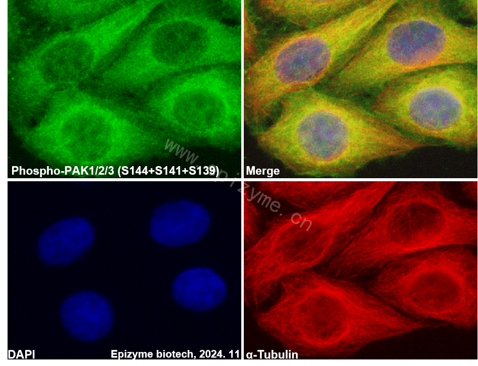 Anti-Phospho-PAK1/2/3 (Ser144+Ser141+Ser139) Rabbit mAb [51K37R33]
