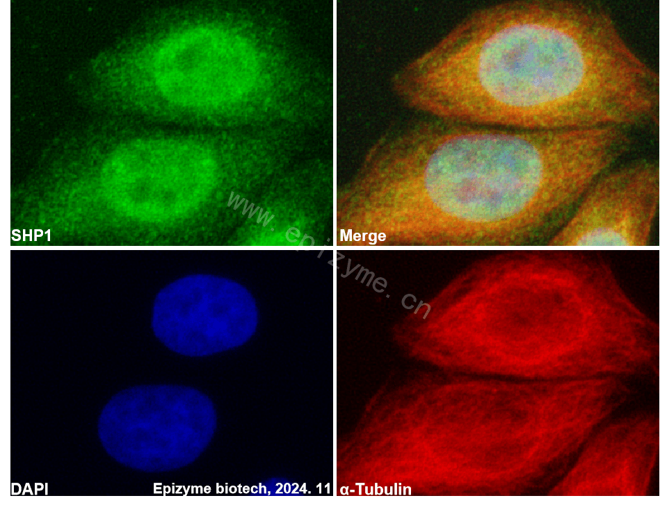 Anti-SHP1 Rabbit mAb [26K02P34]
