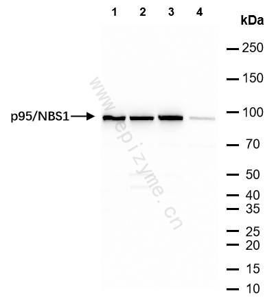 Anti-p95/NBS1 Rabbit mAb [36T47K65]