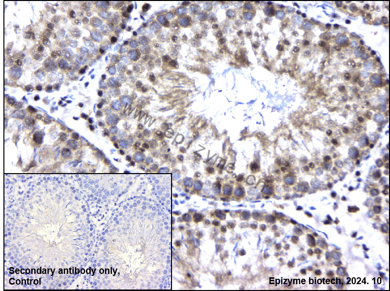 Anti-p95/NBS1 Rabbit mAb [36T47K65]